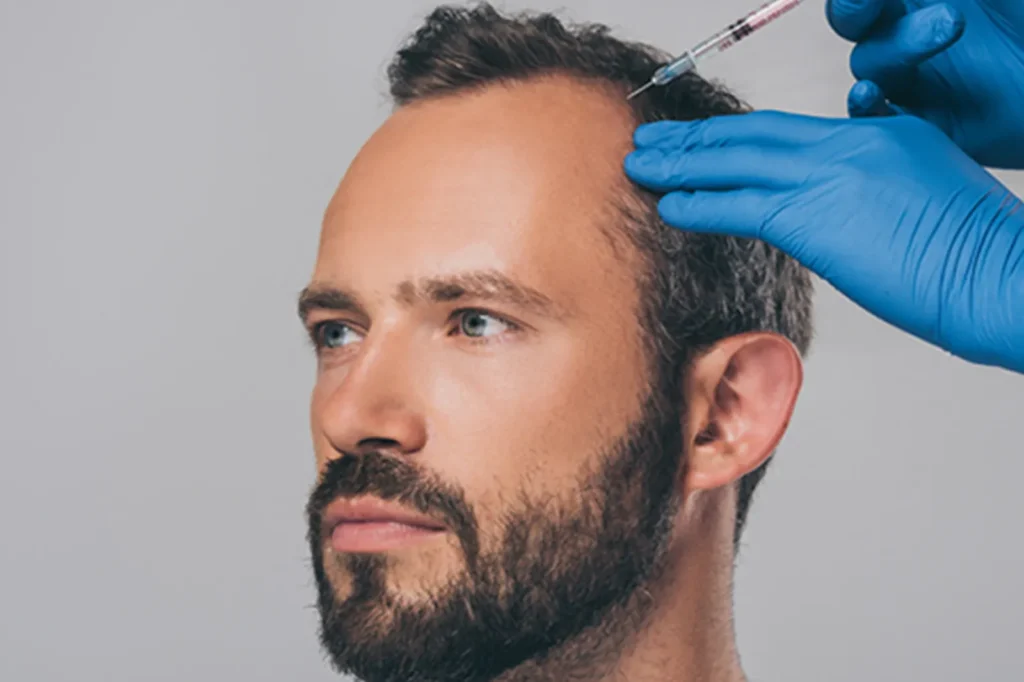Hair Transplant Brighton